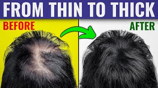 Hair Growth After Cancer  Hair Growth Journey  mymelanomaworld [upl. by Magulac]