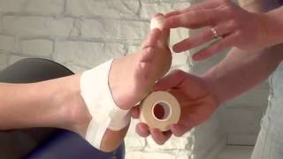 Strapping antalgique de lhallux valgus [upl. by Calan]