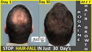 Rogaine Minoxidil for Hair Regrowth in 30 days  Where to buy Rogaine in India  Mens Fashion Tamil [upl. by Anilecram]