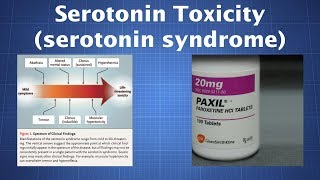 Overdosing on Serotonin What to Know About Serotonin Toxicity [upl. by Ahdar5]