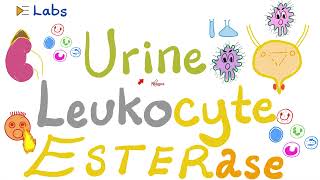 Urine Leukocyte Esterase Urinalysis  Urinary Tract Infections UTI  Labs Playlist [upl. by Nellac205]