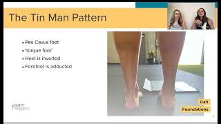 The Tin Man Pattern  Gait Foundations Course Sneak Peak [upl. by Erbes]