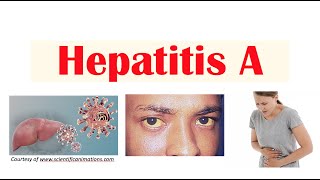 Hepatitis A  Virus Risk Factors Pathophysiology Signs amp Symptoms Diagnosis Treatment [upl. by Sev]