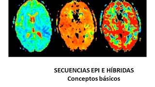 RESONANCIA MAGNÉTICA NUCLEAR ANEXO 10 Secuencias EPI e híbridas [upl. by Eustace419]