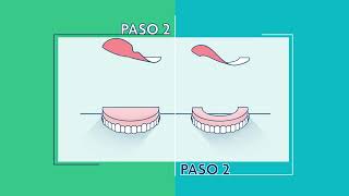 Algasiv SP How to 81 [upl. by Oesile]