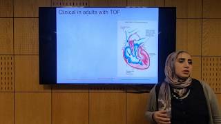 Fallot Tetralogy Part 1  Soha Romeih [upl. by Htnnek]