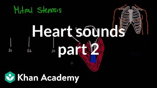 Systolic murmurs diastolic murmurs and extra heart sounds  Part 2  NCLEXRN  Khan Academy [upl. by Crandell512]