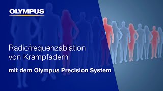 Krampfadern schonend und sicher behandeln  Precision System  OLYMPUS [upl. by Frederick998]