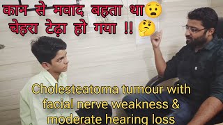 कान का बहना  चेहरा टेढ़ा होना  csom mastoiditis nerve palsy nerve grafting in pediatric patient [upl. by Rednael]