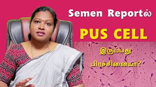 PUS cells in semen analysis report in tamil DrPIswarya Devi MDSiddha [upl. by Rentsch926]