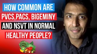 How common are PVCs PACs NSVT and Bigeminy in otherwise completely healthy normal people [upl. by Aitnauq]