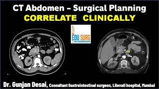 Correlate Clinically  Abdomen Imaging  CT scan abdomen interpretation  Radiology masterclass [upl. by Elfont450]