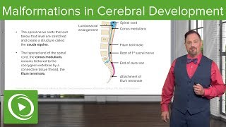 Malformations in Cerebellar Development – Embryology  Lecturio [upl. by Ellesij]