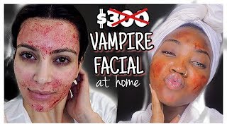 VAMPIRE FACIAL AT HOME  SKIN MICRONEEDLING  BANISH SKINCARE [upl. by Udall]