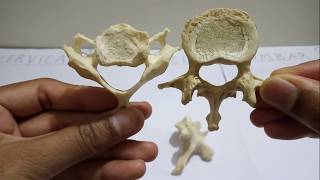 Vertebrae  Identification Features amp Differences [upl. by Nader234]