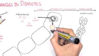 Treatment and Management of Type 2 Diabetes [upl. by Iglesias]