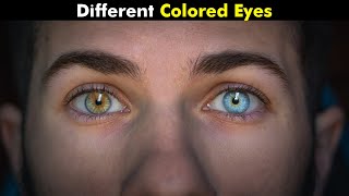 Heterochromia  Different Colored Eyes UrduHindi [upl. by Bevon376]