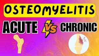 Osteomyelitis  Acute vs Chronic Osteomyelitis  Explained in 5 Minutes [upl. by Yreneh]