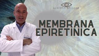 Come e perché si forma la Membrana epiretinica  Pucker Maculare [upl. by Isidore928]