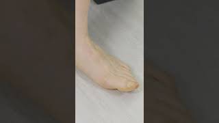 shorts Treatment of a bunion ie adduction of the big toe  how do I do it [upl. by Ajet694]