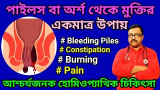 Piles বা অর্শ এর হোমিওপ্যাথি ওষুধ  পাইলস থেকে মুক্তির উপায়  Homeo Medicine [upl. by Eznyl850]