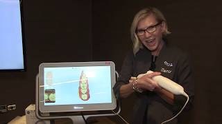 Scanning for a SingleUnit Crown with the iTero Element® 2 Intraoral Scanner [upl. by Nauqaj]