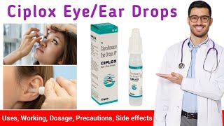 Ciplox EyeEar drops uses in hindi  Ciplox Eye Drops in hindi  Ciplox Ear Drops in hindi [upl. by Selina]