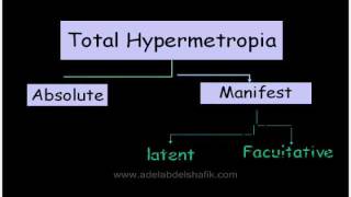 Errors of refraction for undergraduates  Hypermetropia [upl. by Einnej]