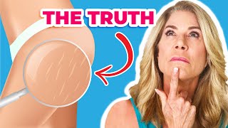 The TRUTH About Cellulite Every Woman NEEDS to Know [upl. by Bilac]