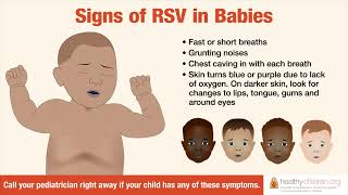 Signs amp Symptoms of RSV in Babies  AAP [upl. by Tiffa696]