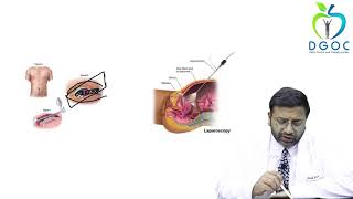 Hernia Surgery  Laparoscopy  Robotic Surgery  Abdominal Wall Reconstruction [upl. by Drisko]