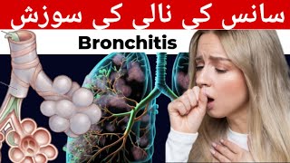 Bronchitis in HindiUrdu Causes Symptoms Bronchitis Treatment [upl. by Landis]