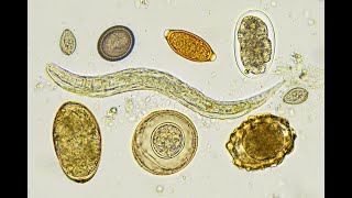 Stool amp Sputum Examination [upl. by Jon]