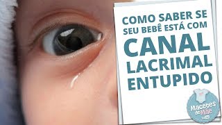 CANAL LACRIMAL ENTUPIDO E COMO TRATAR A OBSTRUÇÃO  MACETES DE MÃE [upl. by Remmus]