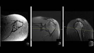 23 year old male with shoulder pain [upl. by Erdnaxela209]