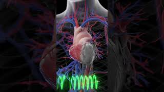 Watch as a Heart Attack unfolds anatomy heartattack [upl. by Enelyt18]