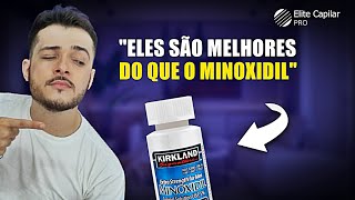 SUBSTITUTOS NATURAIS DO MINOXIDIL  Aula 62 [upl. by Adnilg666]