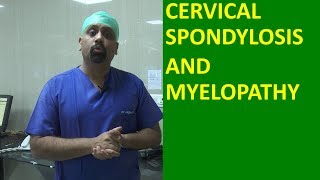 What is Cervical spondylosis Cervical Spinal cord compression and Myelopathy मानेचा संधिवात [upl. by Ellswerth877]