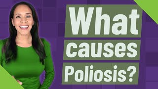 What causes Poliosis [upl. by Dhiren]