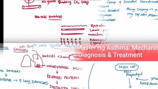 Chronic obstructive pulmonary disease  Chronic Bronchitis Emphysema Asthma Bronchiectasis [upl. by Ahsiekim]