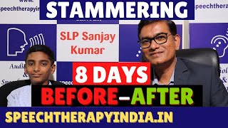 SLP Sanjay Kumar  PrePost  हकलाहट Stammering Speech Therapy Within 8 Days  AIIMS Delhi Alumnus [upl. by Ursula]