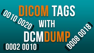 How to view DICOM Tags with DCMDUMP [upl. by Newlin]