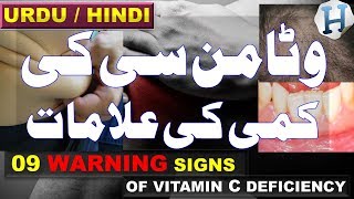 Vitamin C Benefits  Vitamin C Deficiency Symptoms amp Vitamin C Rich Foods  Health Tips Urdu Hindi [upl. by Ahsaei]