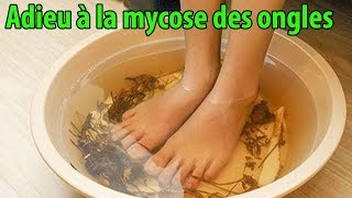 Adieu à la mycose des ongles avec ces méthodes de traitement naturel  conseils [upl. by Enyale]