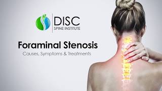 Pinched Nerve in Neck or Back Foraminal Stenosis Causes Symptoms Treatments [upl. by Adliw85]