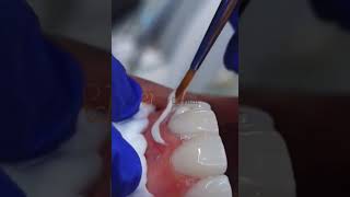 Transformed ukdentist dentalcare ukdentistry dentalprocedure dentalroutine dentaltreatment [upl. by Winslow]