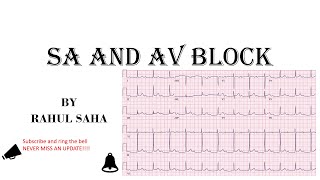 SA and AV BLOCK  SINOATRIAL AND ATRIOVENTRICULAR HEART BLOCK USMLE EXAM [upl. by Neeron]