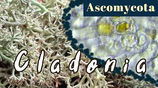 Cladonia arbuscula under the Microscope Mosslike lichensAscomycota [upl. by Herstein]