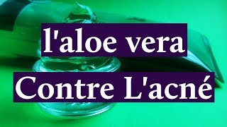 Comment Utiliser laloe Vera Pour Lacné [upl. by Janey]