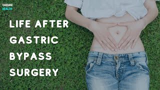 Life After Gastric Bypass Surgery [upl. by Sakul]